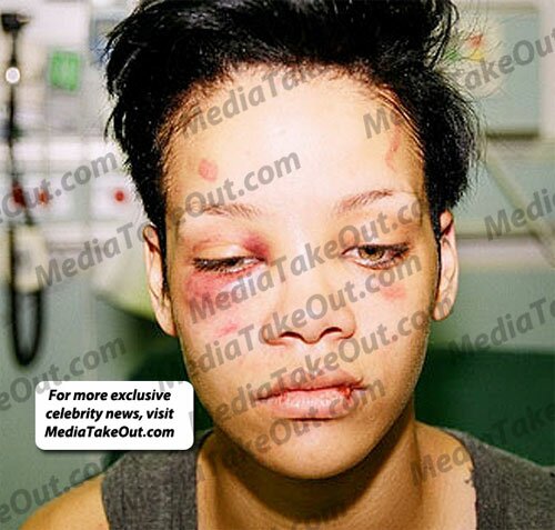 rihanna pictures after beating photos. surface of Rihanna after